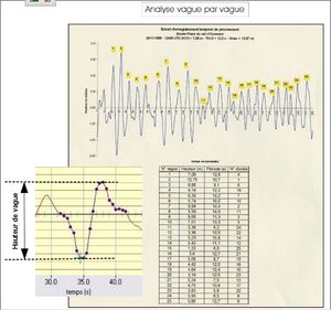 Figure 11- Définition des hauteurs de vagues par l'analyse vague par vague.jpg